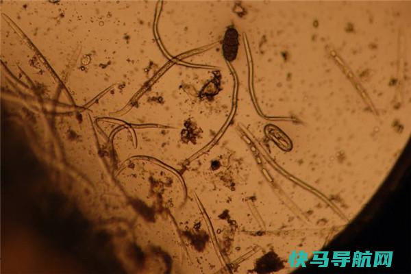 恶魔线虫：栖身在最深畛域的生物（生命力倔强的生物）