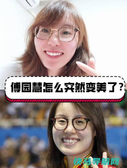 牙齿矫正大概要花费多少钱，5000元到15000元（最佳年龄12-16岁，需矫正半年到1年左右）