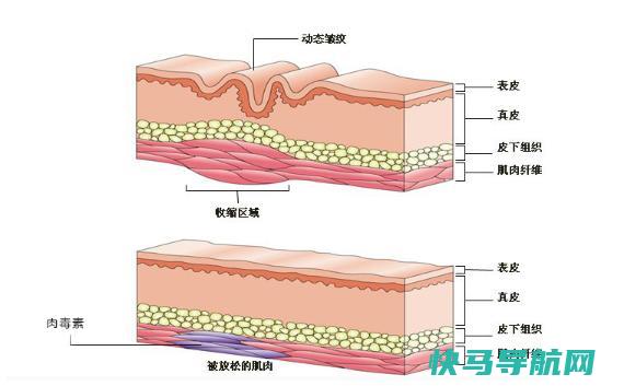 面部皱纹出现的顺序是怎么样的？皱纹的分类