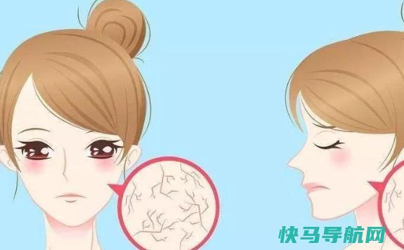 秋季用什么护肤品好？秋季干皮怎么护肤
