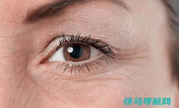眼周有皱纹是缺水吗？去除皱纹的3个方法