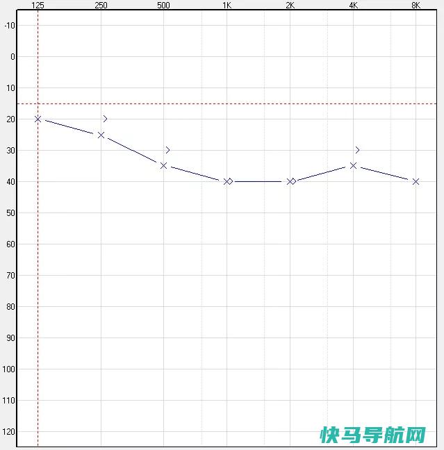 听力下降的表现有哪些