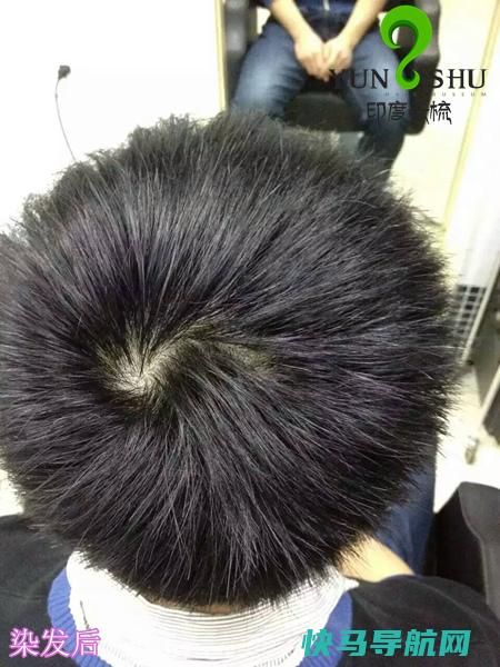 惊 白发染黑相当危险
