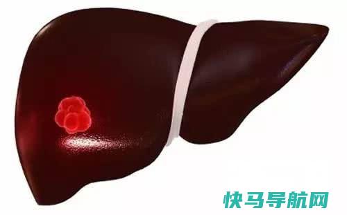 肝癌是怎么引起的原因？饮食要注意什么